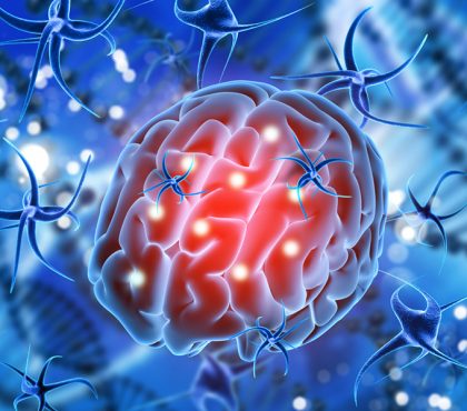 3D medical animation project