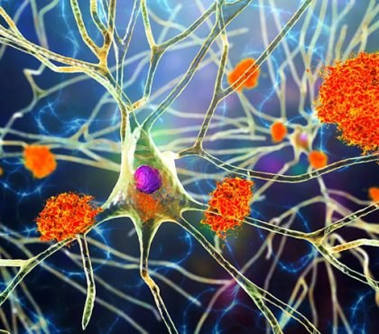 Animation is the Best Visual Type for MOA Pharma in 2025